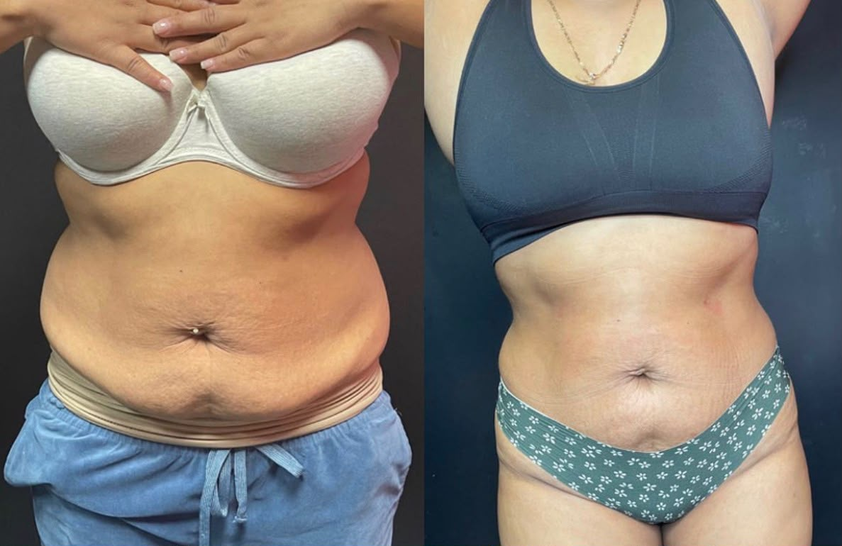 Client transformation 4