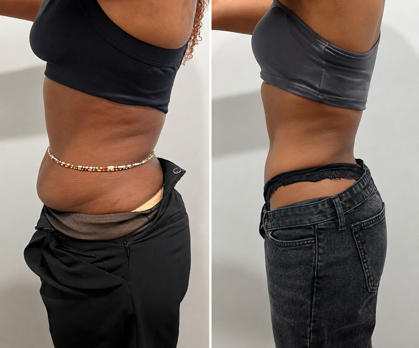 Client transformation 5