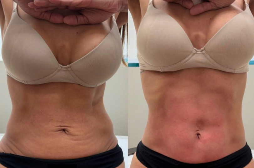 Client transformation 3
